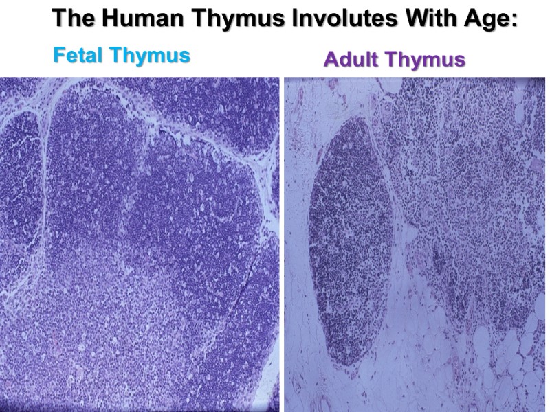 Adult Thymus Fetal Thymus The Human Thymus Involutes With Age: